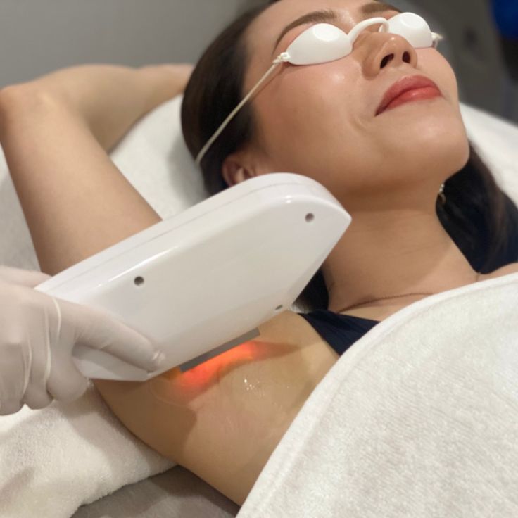 Armpits Laser Hair Removal