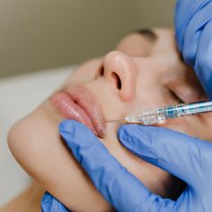 Lip Fillers